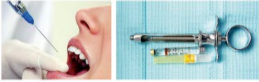 胰島素，牙科麻醉6.png
